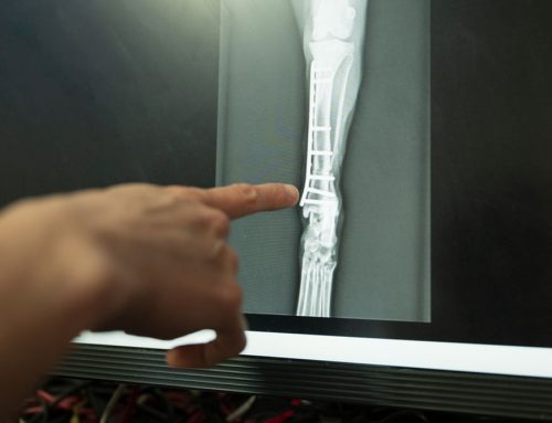 Senior Screening: Blood Pressure, Thyroid, and X-Rays